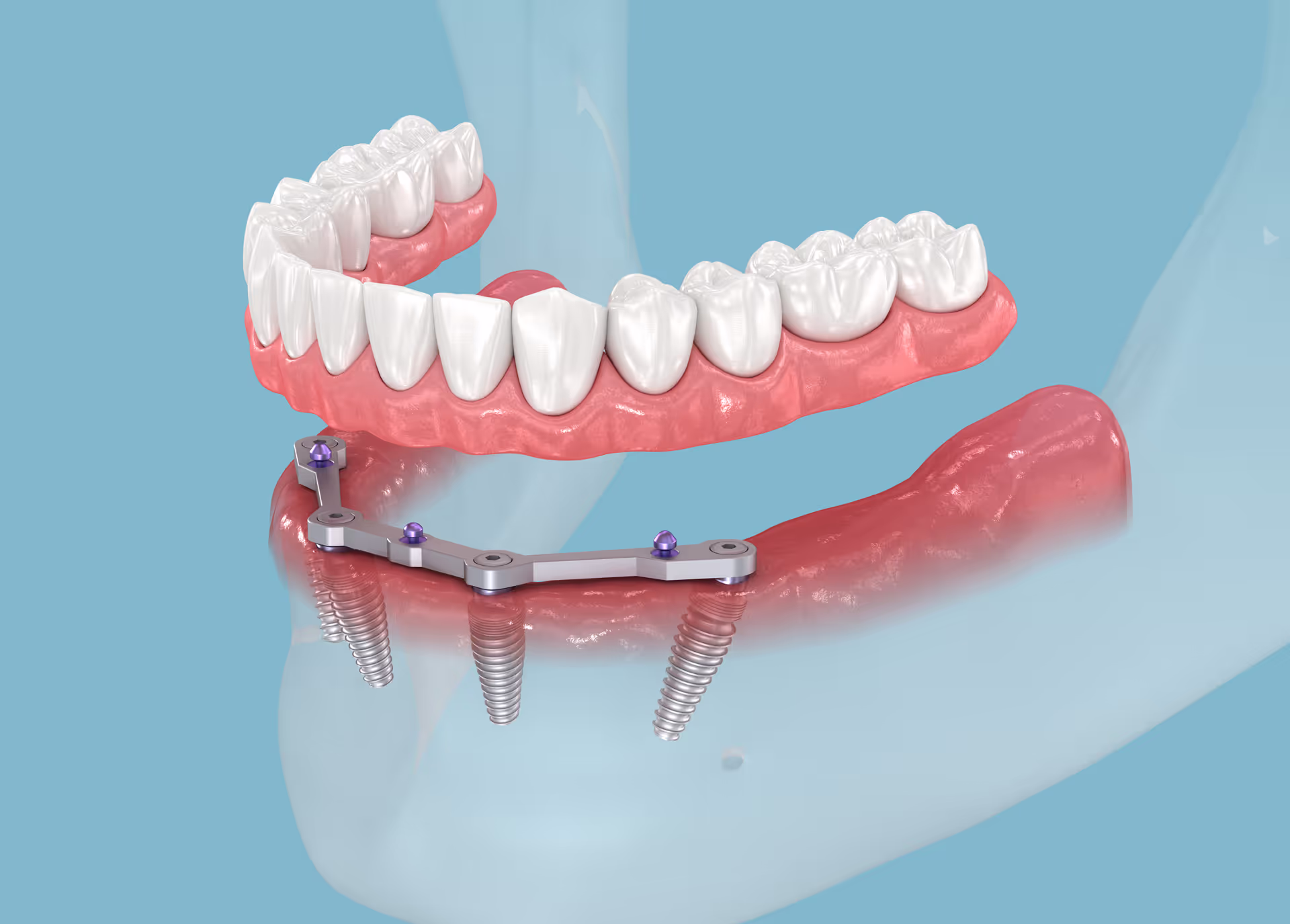 General Dentistry