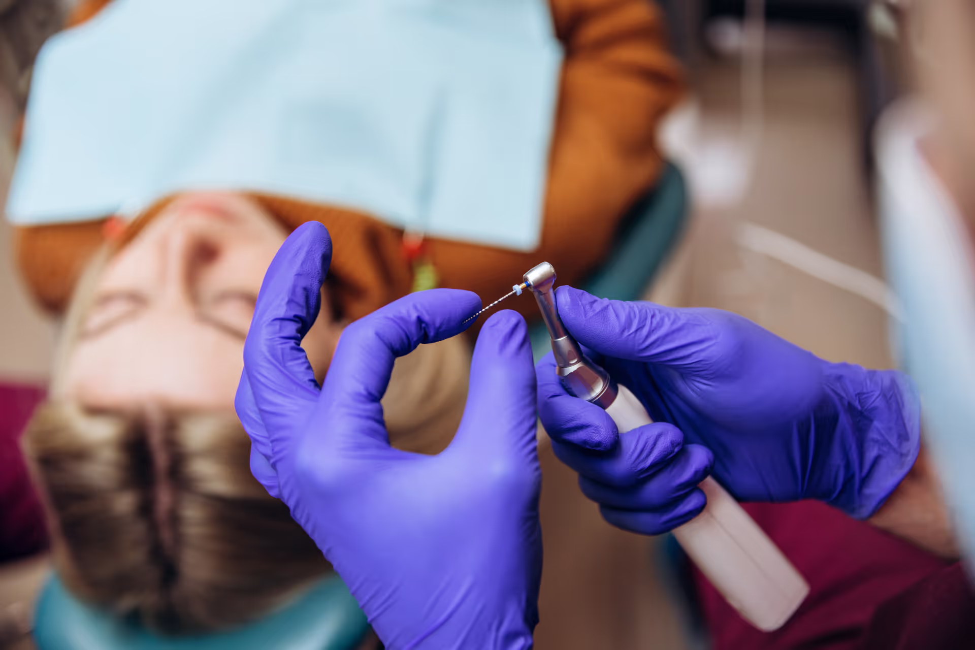 Root Canals