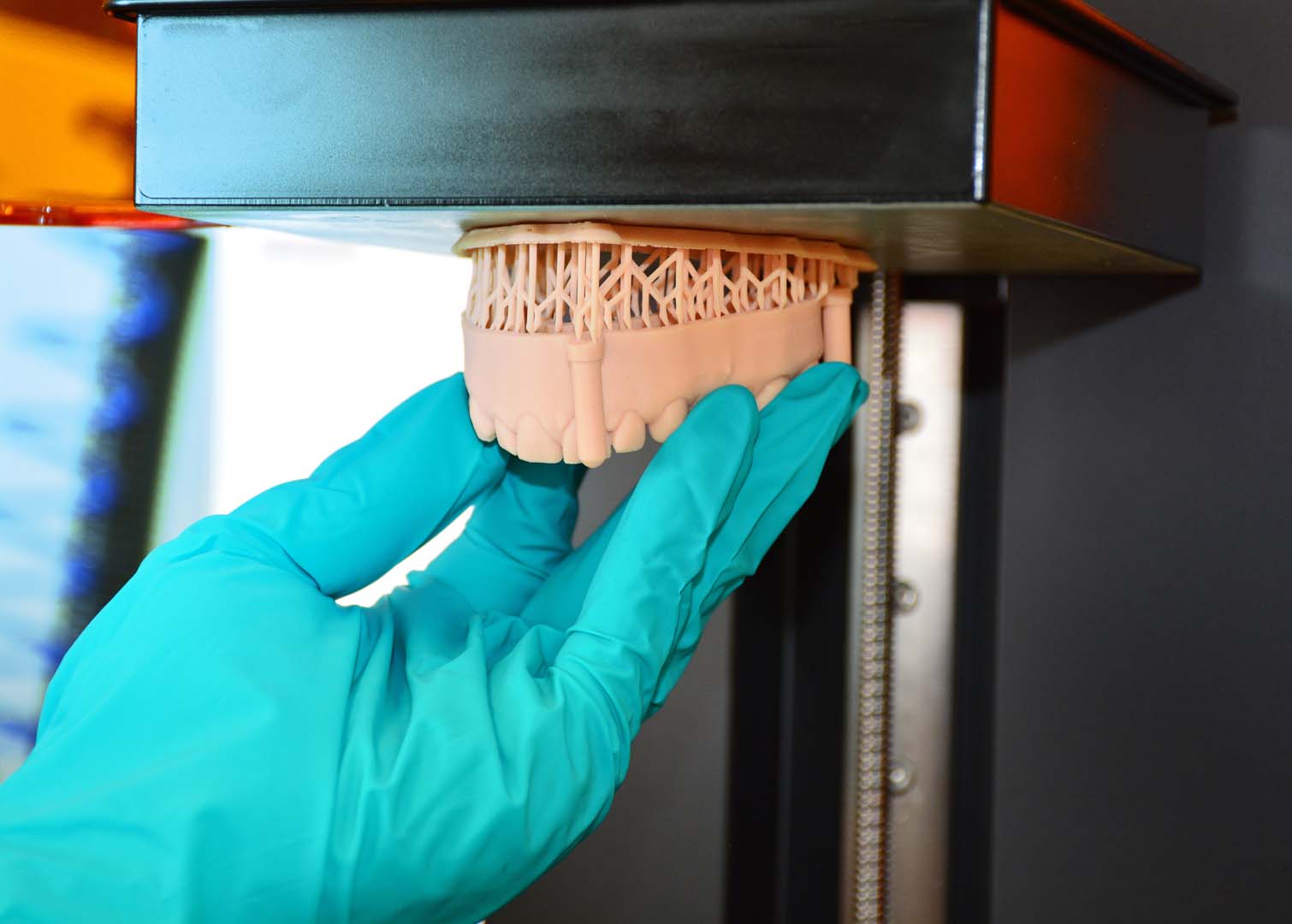 Digital Dentures
